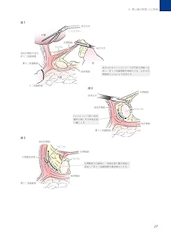 大阪日赤ラパロ教室 イラストで学ぶ腹腔鏡下胃切除[DVD付] 大阪日赤ラパロ教室 イラストで学ぶ腹腔鏡下胃切除[DVD付
